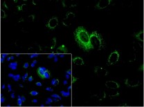 Smad3 Recombinant Rabbit Monoclonal  Antibody