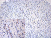 CXCL13/BCA1 Rabbit Polyclonal Antibody