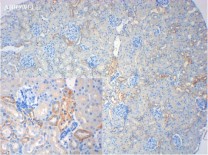 ACE2 Rabbit Polyclonal Antibody