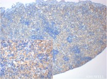 ACE2 Rabbit Polyclonal Antibody