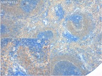 ULK1 Rabbit Polyclonal Antibody