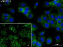 Claudin 3 Rabbit Polyclonal Antibody