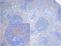 LAMP1 Rabbit Polyclonal Antibody