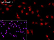 FOXP1 Recombinant Rabbit Monoclonal Antibody