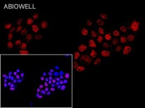 p53(Phospho Ser392) Rabbit Polyclonal Antibody