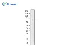 IgA Recombinant Rabbit Monoclonal Antibody