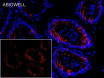 ACSL3 Rabbit Polyclonal Antibody