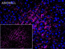 ASGR1 Recombinant Rabbit Monoclonal Antibody