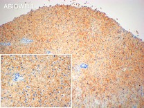 ASGR1 Recombinant Rabbit Monoclonal Antibody