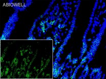  LATS1/2 Rabbit Polyclonal Antibody