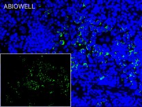 MALT1 Recombinant Rabbit Monoclonal Antibody