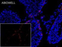 MALT1 Recombinant Rabbit Monoclonal Antibody