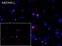 METTL3 Recombinant Rabbit Monoclonal Antibody