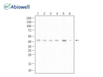 MMP12 Recombinant Rabbit Monoclonal Antibody