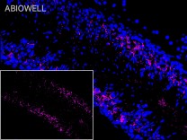 MYD88 Recombinant Rabbit Monoclonal Antibody