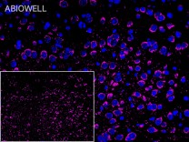 PDGFB Recombinant Rabbit Monoclonal Antibody