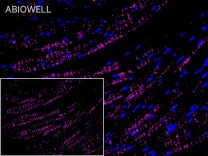 PDGFB Recombinant Rabbit Monoclonal Antibody