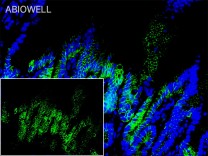 MALT1 Recombinant Rabbit Monoclonal Antibody