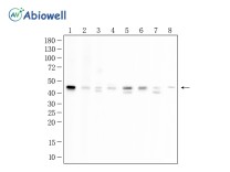 TIA1 Recombinant Rabbit Monoclonal Antibody