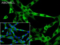 TPH2 Recombinant Rabbit Monoclonal Antibody