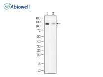 PI3 Kinase p110δ Recombinant Rabbit Monoclonal Antibody