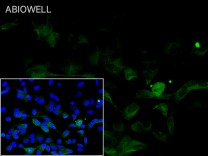 Amyloid-β 1-42 Recombinant Rabbit Monoclonal Antibody