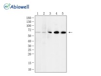 CBS Recombinant Rabbit Monoclonal Antibody