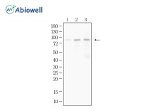 NSUN2 Recombinant Rabbit Monoclonal Antibody