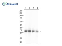 PSMB9 Recombinant Rabbit Monoclonal Antibody