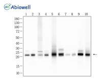 PSMB9 Recombinant Rabbit Monoclonal Antibody