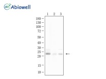 PSMB9 Recombinant Rabbit Monoclonal Antibody