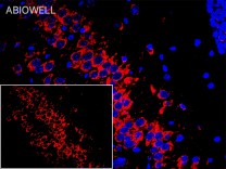 SERCA2 Recombinant Rabbit Monoclonal Antibody