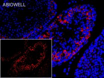 SERCA2 Recombinant Rabbit Monoclonal Antibody