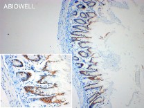 SFRS6 Recombinant Rabbit Monoclonal Antibody