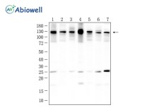 ULK1 Recombinant Rabbit Monoclonal   Antibody