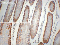 YB-1/YBX1 Recombinant Rabbit Monoclonal Antibody