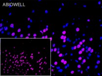 AKT1 Recombinant Rabbit Monoclonal Antibody