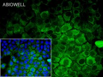 Annexin I Rabbit Monoclonal Antibody