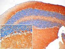 ATP1A2 Recombinant Rabbit Monoclonal Antibody