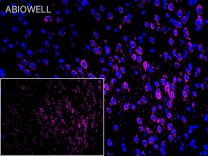 DRP1(Phospho Ser616) Recombinant Rabbit Monoclonal Antibody