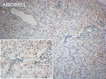 Histone H3(Acetyl K14) Recombinant Rabbit Monoclonal Antibody