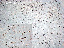 Histone H3(Acetyl K14) Recombinant Rabbit Monoclonal Antibody