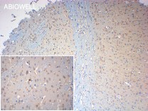  LATS1/2 Rabbit Polyclonal Antibody