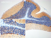 SERCA2 Recombinant Rabbit Monoclonal Antibody