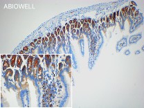 Stathmin 1 Recombinant Rabbit Monoclonal Antibody