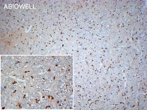 Stathmin 1 Recombinant Rabbit Monoclonal Antibody