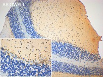 Ubiquitin Recombinant Rabbit Monoclonal Antibody