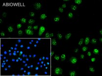 ERK1/2 (Phospho Thr202/T185) Recombinant Rabbit Monoclonal Antibody