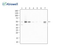 YB-1/YBX1 Recombinant Rabbit Monoclonal Antibody