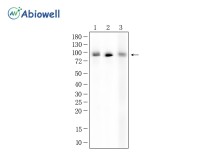 HSPA4 Recombinant Rabbit Monoclonal Antibody